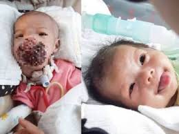Menerima diagnosis kanser tahap 3 boleh menyusahkan, tetapi jangka hayat dan rawatannya bertambah baik sepanjang masa. Survival Kanak Kanak Penghidap Kanser