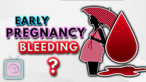 This may look like coffee grounds. Implantation Bleeding Early Pregnancy Bleeding Spotting 10 Important Facts Youtube