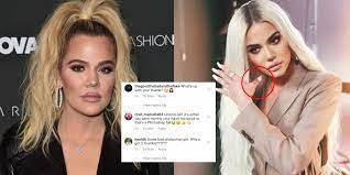 Khloé kardashian | charles sykes/bravo/nbcu photo bank. Khloe Kardashian Mocked After Sharing A Badly Photoshopped Image Featuring Two Thumbs On One Hand Indy100 Indy100