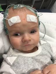 Lily's first seizures