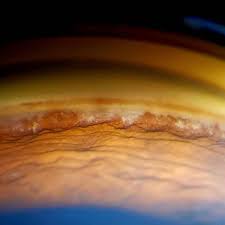 Profile for Oftalmólogo Dr. Fidel Padilla Baca