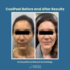 Meet our new provider, Katelyn Ely! We are so excited to welcome you to  Babcock Dermatology! Katelyn (DeBerry) Ely, PA-C, is a board-certified  Physician Assistant specializing in medical dermatology. She brings several