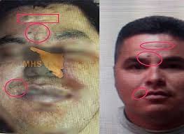 EJECUTAN EN JALISCO A "EL CHAPO TRINI" LIDER DE "LOS BELTRÁN LEYVA" Y  PRESUNTO TÍO DE ALFREDO OLIVAS Fue ejecutado a balazos Trinidad Olivas  Valenzuela "Chapo Trini", miembro del Cartel de los