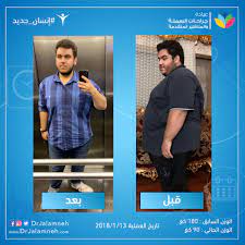 gallery obesity and advanced laparoscopic surgery clinics