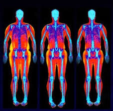 Dexa Scan For Body Fat Visceral Fat Bone Health The Gold Standard For Fitness Testing Fitness Lab Testing Body Fat Testing Dexa Blood Testing Metabolic Testing