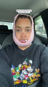 bye bye wisdom teeth!!!