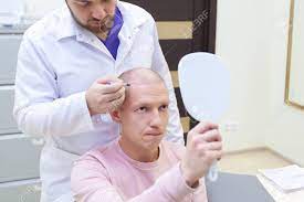 Hair loss affects 50% of men over the age of 50, yet hair loss can start for some in their 20s. Baldness Treatment Patient Suffering From Hair Loss In Consultation With A Doctor Preparation For Hair Transplant