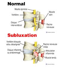 Si ce n'est qu'au réveil, commencer par changer de matelas… puis voir un médecin pour qu'il prescrive une radio et des séances de kiné. Maux De Cou Quoi Faire Pour Soulager La Douleur Et Eviter Les Recidives