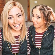 Common hair loss misconception: You have to be nearly or completely bald to  wear a wig or alternative hair. ⁣ ⁣ FALSE. NOPE. NADA. NOT TRUE. ⁣ ⁣ For me  it was