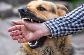 3 Ways a Dog Bite Injury Can Have Psychological Ramifications on a Victim |  C&B Law Group, LLP