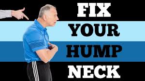 We did not find results for: Single Best Fix 6 Min For Neck Hump Buffalo Hump Youtube