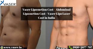 How much does stomach liposuction cost 9. Vaser Liposuction Cost Abdominal Liposuction Cost Vaser Lipo Laser Cost In India By Vaser India Medium