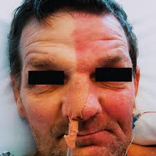 Image result for Harlequin Color Change