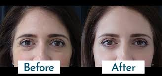 Dr. Megha Vyas January 2025