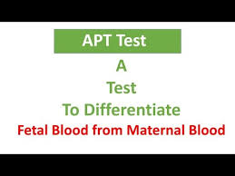 Image result for Modified Apt Test