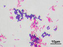 Enterica is the type species and is further divided into six subspecies that include over 2. Gram Farbung Wikipedia