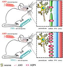 Improving Huntington S Disease Therapy With Mesenchymal Stem Cells Stem Cells Portal