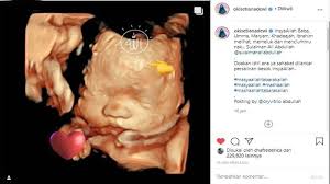 May 26, 2021 · namun, dewi fortuna belum berpihak kepada skuad garuda. Potret Hasil Usg Ustazah Oki Setiana Dewi Jadi Sorotan Terungkap Nama Keponakan Ke 4 Ria Ricis Halaman All Tribun Manado