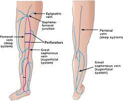 Basic Anatomy Of The Venous System Of The Lower Extremities Download Scientific Diagram