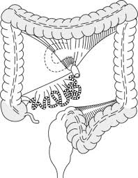 Proposed Pathophysiological Pathways, 1?2 That Explain Female... | Download  Scientific Diagram
