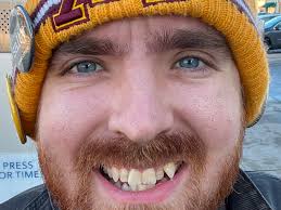 Fundraiser by Frank Bass : Help Frank Overcome Facial Neuropathy