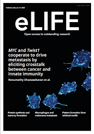 At least some key portion of the actions of servicing an interrupt is necessarily serialized: Renumathyd On Twitter A Press Release On Our Paper And Highlighted On The Cover Of Elife Two Cancer Causing Genes Work Together To Promote Metastasis Https T Co 88e7ffivua Via Medical Xpress Labdfelsher Virginiebaylot Wadiem12 Stanford Gi