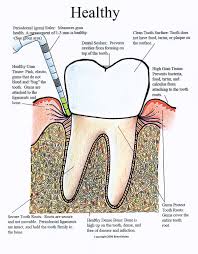 periodontal charting wikipedia