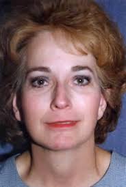 Facelift Surgery San Jose Mountain View CA