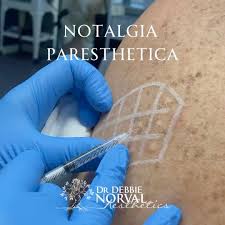 Image result for Notalgia Paresthetica