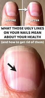 Pin On Health Tips Fitness Motivation