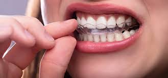 Mouthwashes are used by millions of people, morning and night, as part of their oral health routine. How Long Does A Night Guard Last Pro Teeth Guard