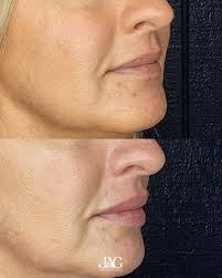 🥁Summerville Journal Scene's Readers Choice 2023: 🥇Best Medical Spa-JAG  Medical Cosmetics 🥇Best Small Business Owner-Jared and Ashton Guichard  🥇Best Weight Loss-JAG Medical Cosmetics 🥇Best Esthetician- Cindy Rieger  @cindy_rieger_skin 🥇Best Tattoo ...