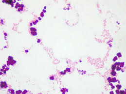 Browse 226 sarcina lutea stock photos and images available, or start a new search to explore more stock. History Of Microbiology