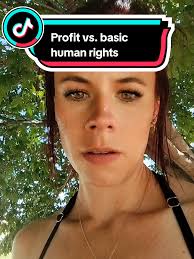 Sunday Swimminh Pool Down Syndrome