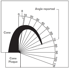 Orton Test Cone Set