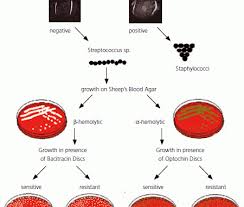 Bacitracin Test Principle Procedure Expected Results