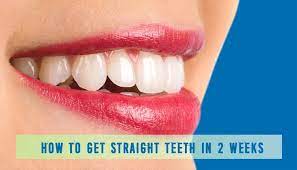 Want to straighten your teeth? How To Get Straight Teeth In 2 Weeks Life Cycle Blog