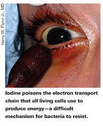 Iodine An Elemental Force Against Infection
