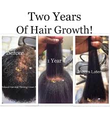 Amplixin Intensive Biotin Hair Growth Serum Reviews Glam Suite Hair Growth Products Hair Loss Hair Growth Oil Glam Suite In 2020 Relaxed Hair Growth Hair Growth Hair Growth Oil