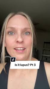 Understanding Lupus Symptoms and Fatigue