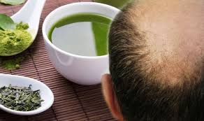 Hair loss reversed is dedicated to helping you fight hair loss. Hair Loss Treatment Green Tea Contains Properties Which Prevents Alopecia And Hair Loss Samachar Central