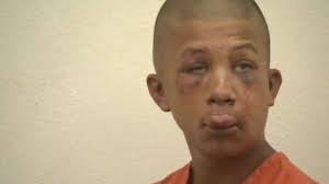 Violent man with a violent history getting away with assault.