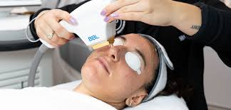 Rejuvenate Your Look with Tailored Dermal Filler Treatments