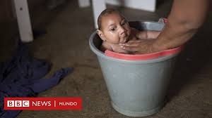 Jul 31, 2021 · tarjetas del día de la madre, tarjetas para el día de las madres, postales animadas para mamá, feliz dia de la madre. Como Se Encuentra Jose Wesley El Bebe Con Microcefalia Que Hace Un Ano Se Convirtio En La Cara Del A Emergencia Global Por El Zika Bbc News Mundo