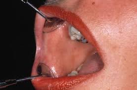 Check spelling or type a new query. Examination Of The Oral Cavity Referral To A Specialist And The Biopsy Procedure Pocket Dentistry