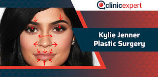 We cover images of kylie jenner before surgery alongwith the changes in kylie skin. Kylie Jenner Plastic Surgery Journey Clinicexpert International