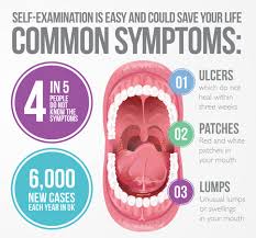 Image result for dental cancer