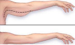 Par la suite, tu auras tout le loisir pour bourriner tes biceps. Raffermir Les Bras Quels Exercices Quand On Est Senior