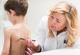 5 Facts About Scoliosis Every Parent Should Know Johns Hopkins Medicine Scoliosis causes a sideways curve of your backbone, or spine. 5 facts about scoliosis every parent