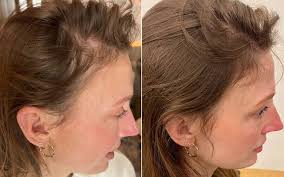 Finally, I found something that solved my thinning hair